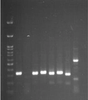 Jundishapur J Microbiol
